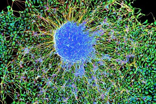 Embryonic Stem Cells Forming Neurons