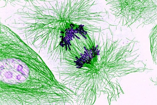 Replicated Chromosomes in a Dividing Cell