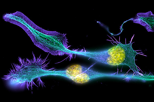 Developing Nerve Cells