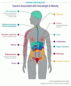 Infographic - Cancers Associated with Obesity