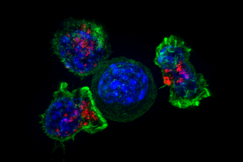 Killer T Cells Surround a Cancer Cell