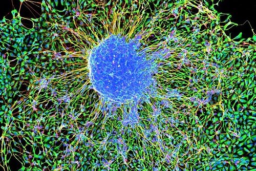 Marmoset Embryonic Stem Cells Forming Neurons