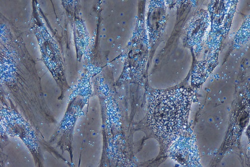 Adipose Tissue-Derived Stem Cells