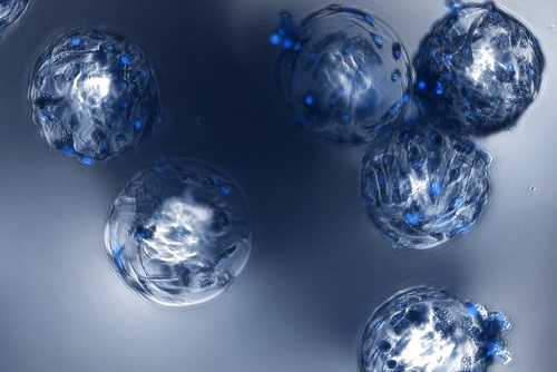 Adipose Derived Stem Cells on Microspheres