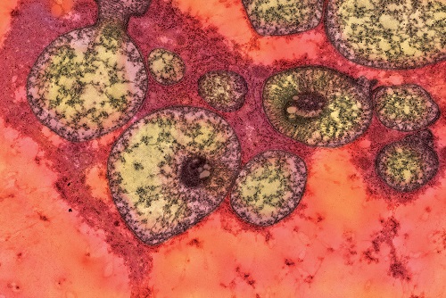 Mutant Mouse Liver Mitochondria