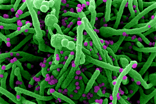 SARS-CoV-2 Infection