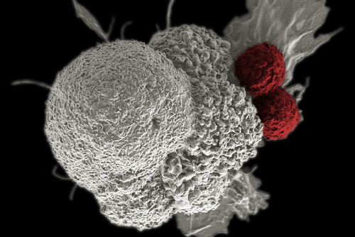 Cancer Immunotherapy