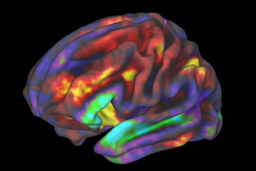fMRI Brain Image