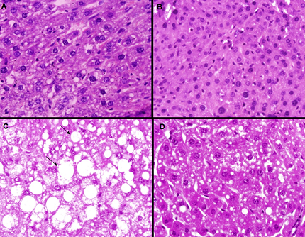 Photomicrographs of Liver Structure and Steatosis