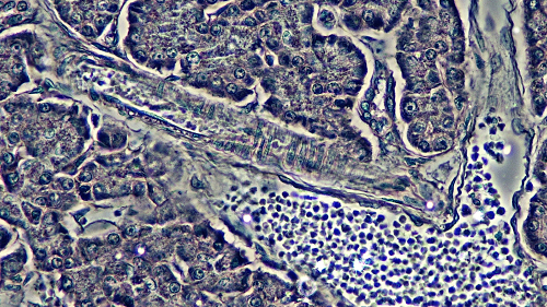 Cross Section of a Human Pancreas