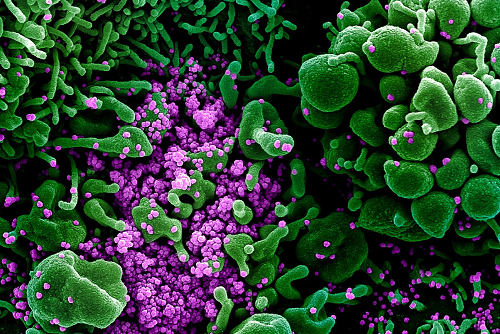 Novel Coronavirus SARS-CoV-2
