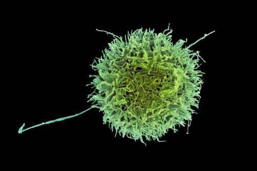 Human Natural Killer Cell