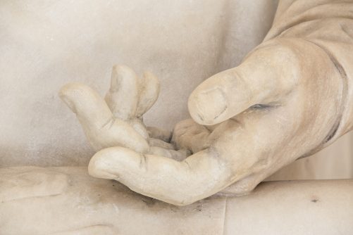 The Hand of Surgeon Theodor Billroth