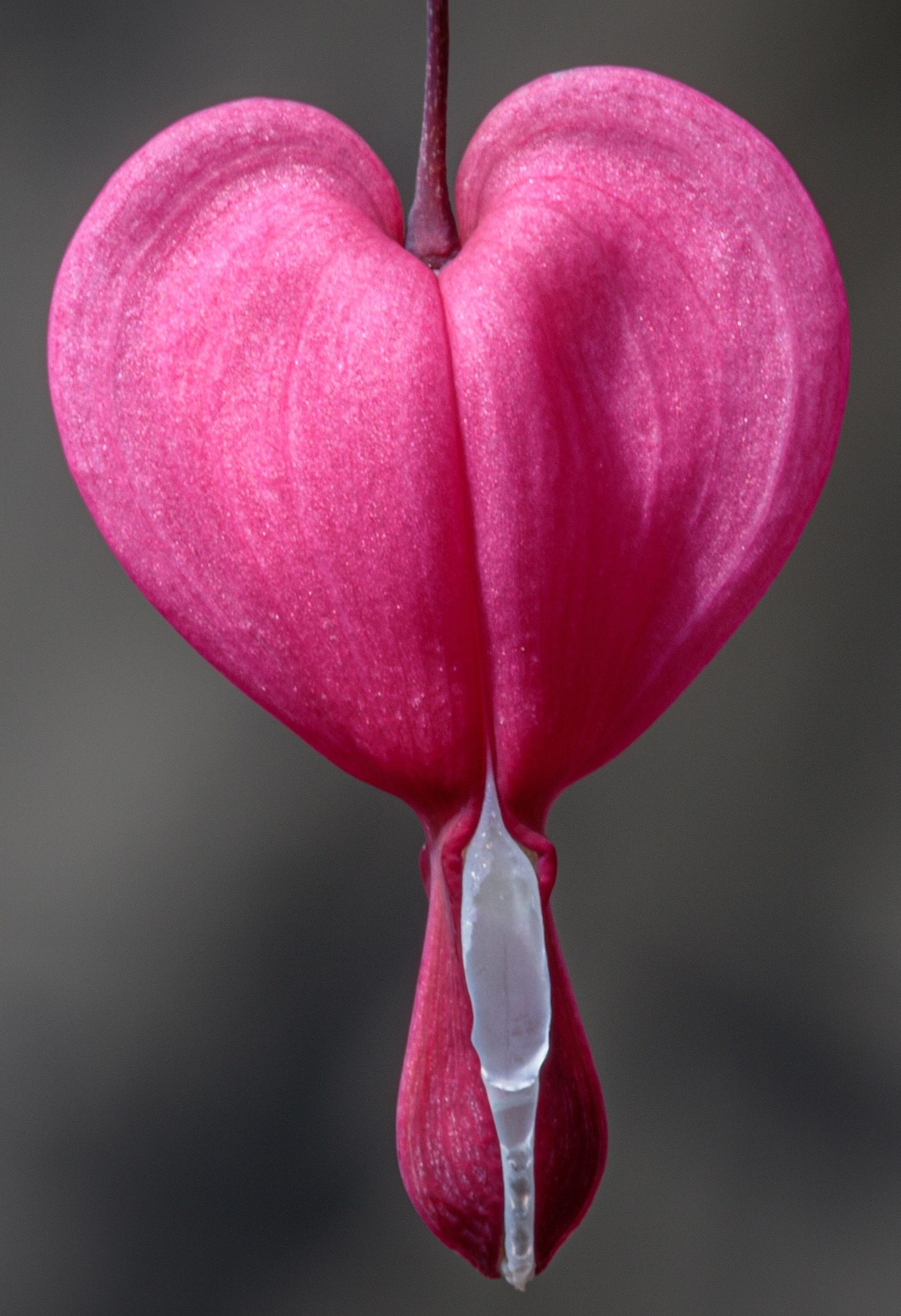 Obesity-Related Heart Deaths More Than Doubled Since 1999