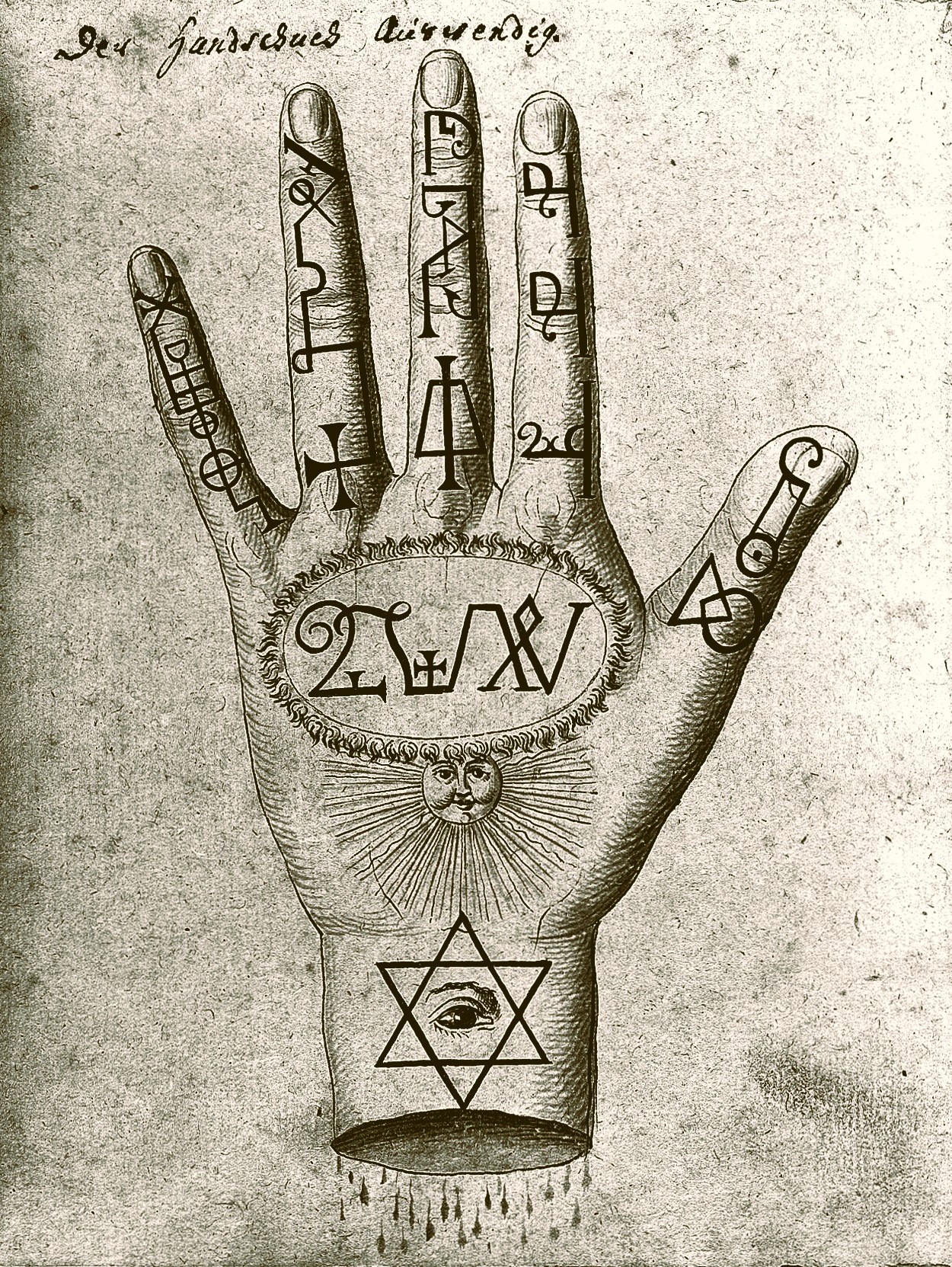 Saying Autism and Obesity Are “Preventable” Raises Ire